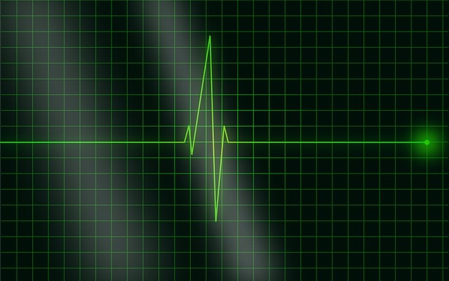 Elettrocardiogramma, battito cardiaco, frequenza